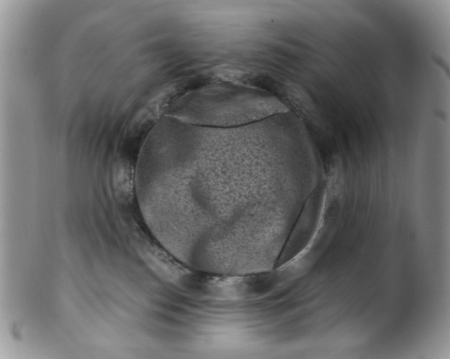 X0000099490186200806051107