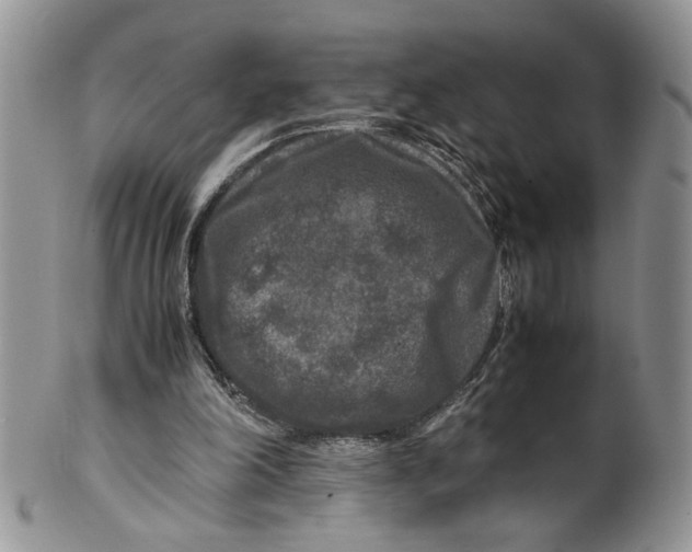 X0000099490198200806051106