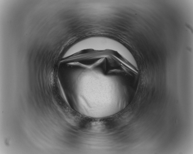 X0000099490216200806051106