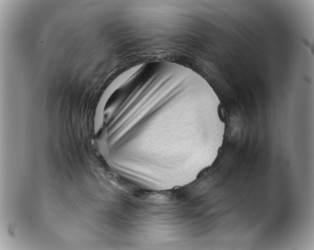 X0000099490236200806051106