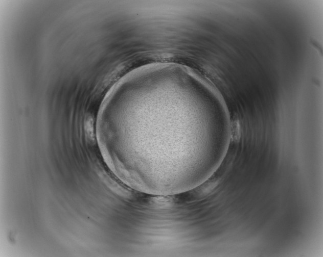 X0000099490238200806051106