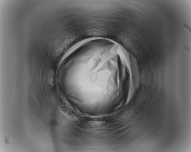 X0000099490255200806051105