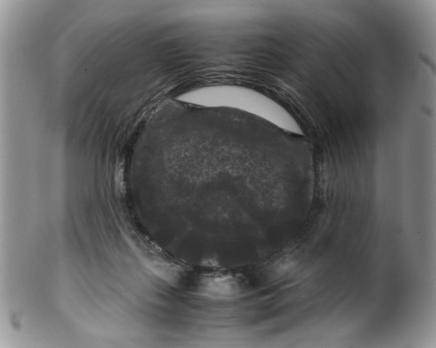 X0000099490267200806051105