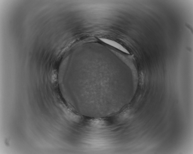 X0000099490284200806051106