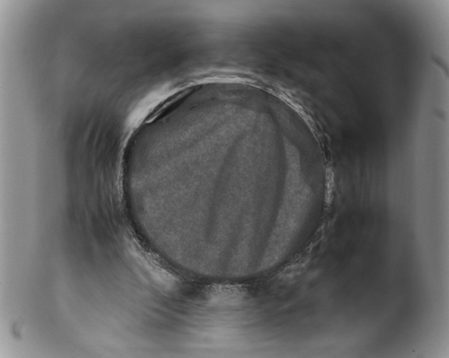 X0000099490296200806051105