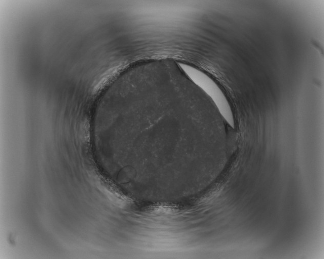 X0000099490303200806051105