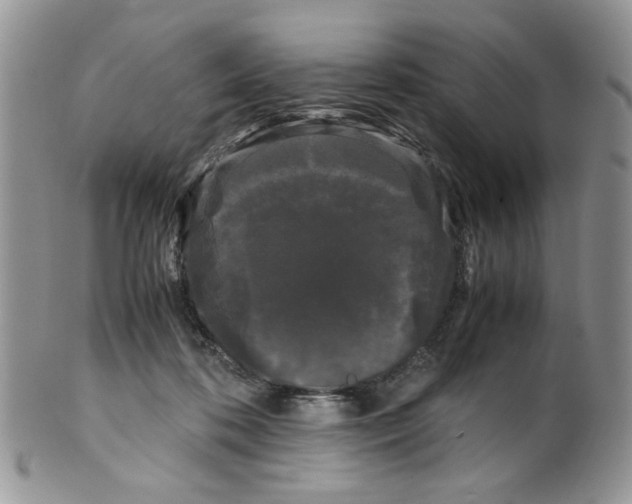 X0000099490316200806051105