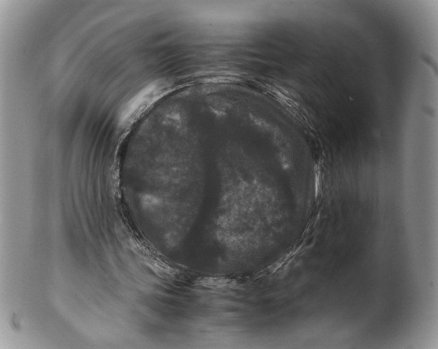 X0000099490339200806051103