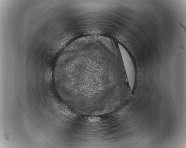 X0000099490355200806051104