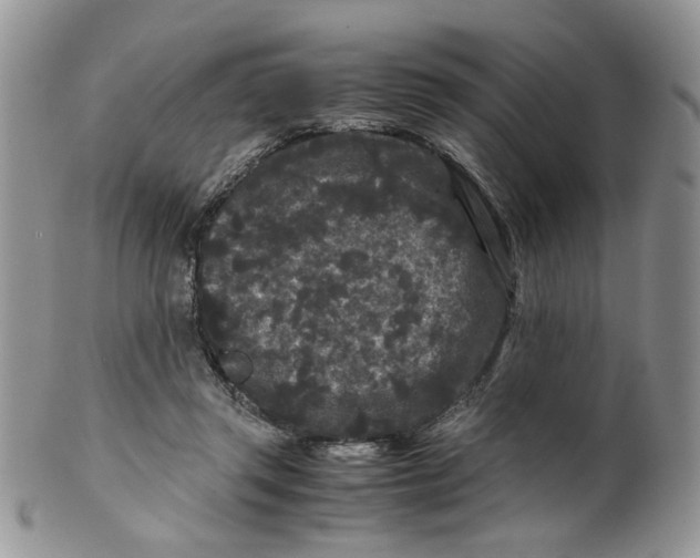 X0000099490357200806051104