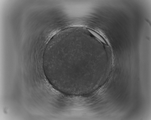 X0000099490385200806051103