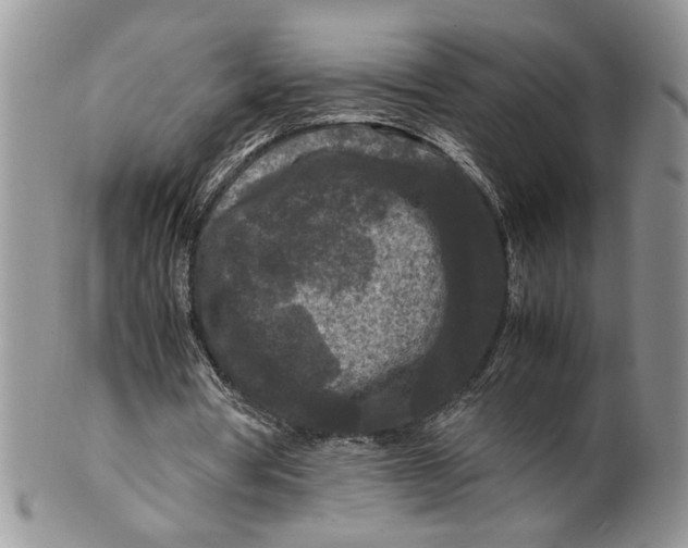 X0000099490386200806051103