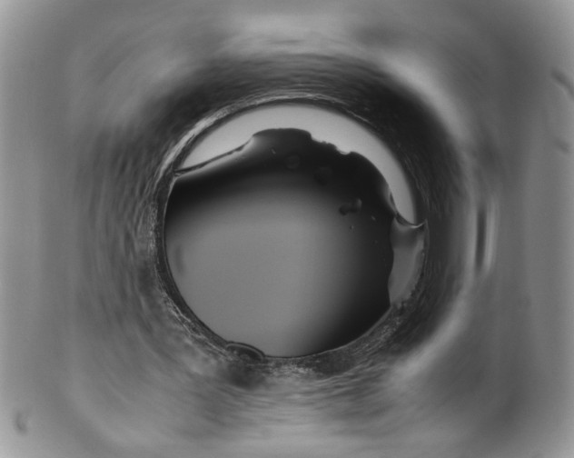 X0000099490387200806051103