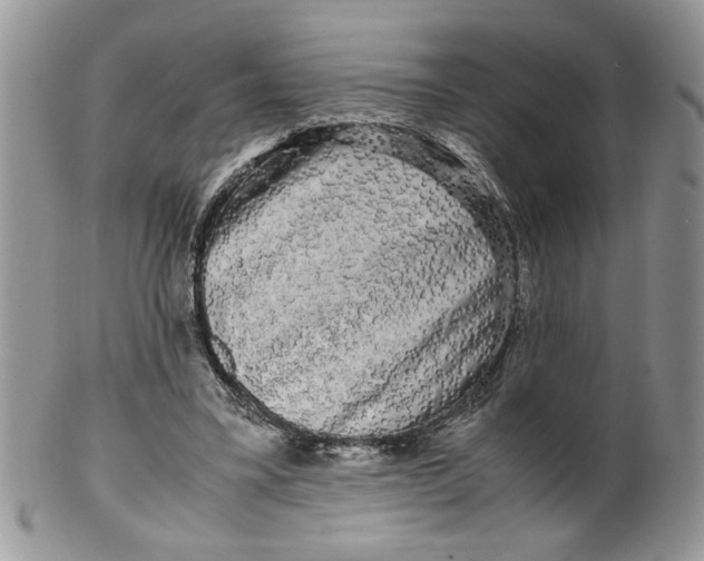 X0000099490395200806051103