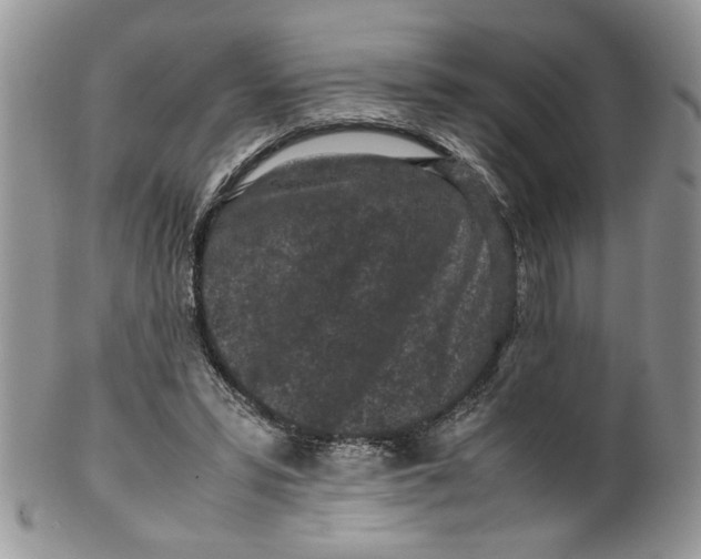 X0000099490399200806051103