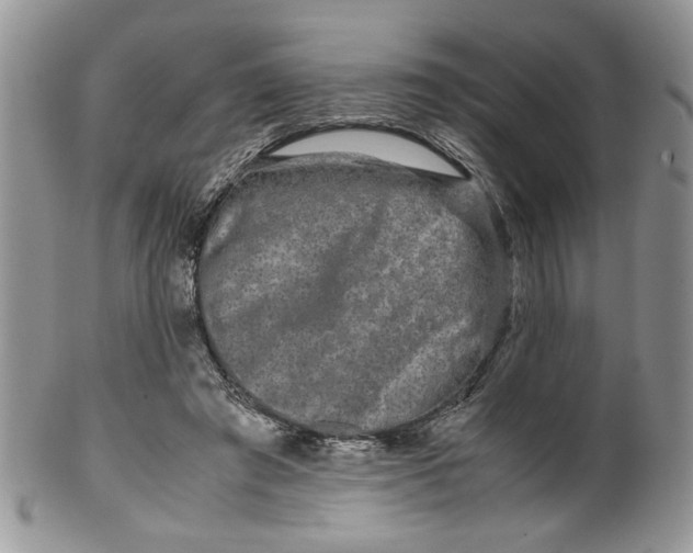 X0000099490401200806051103