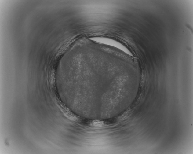 X0000099490413200806051103