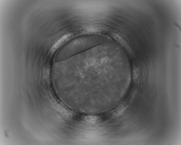 X0000099490444200806051102