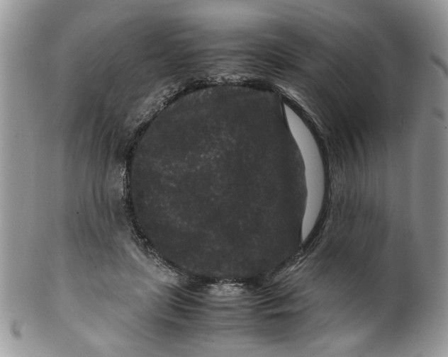 X0000099490451200806051102