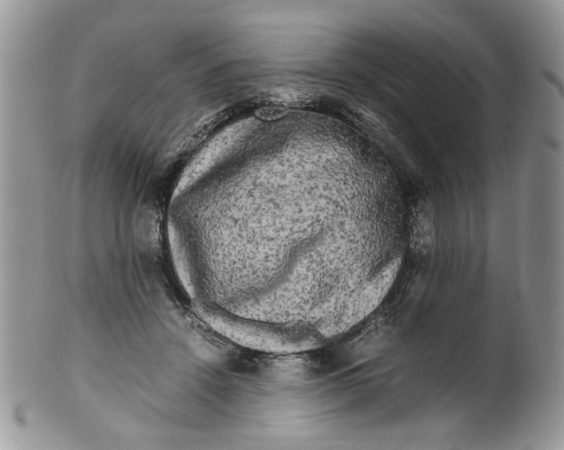 X0000099490456200806051102