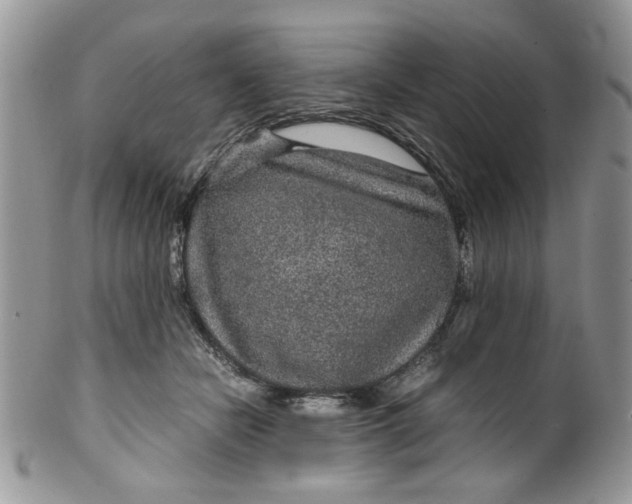 X0000099490462200806051102