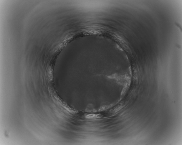 X0000099490465200806051103