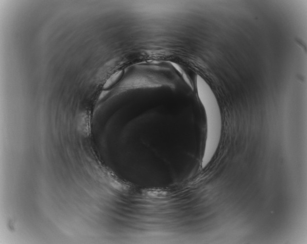 X0000099490471200806051103