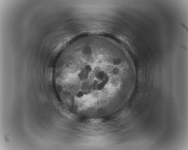 X0000099490495200806051102