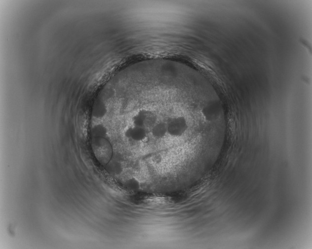 X0000099490499200806051102