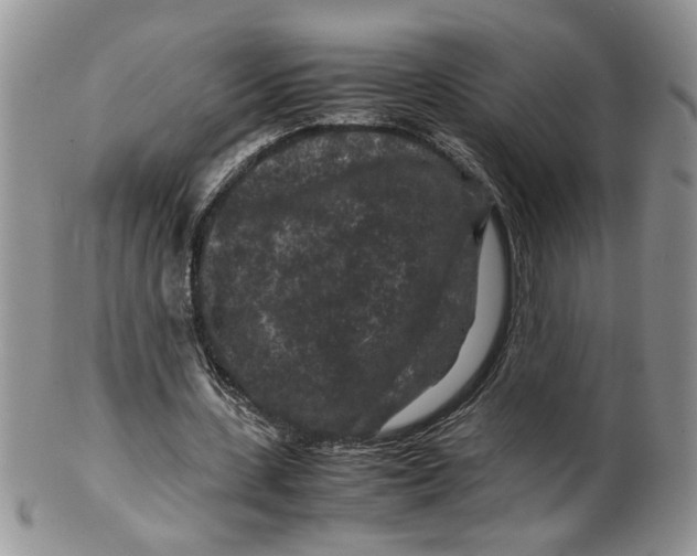 X0000099490531200806051101