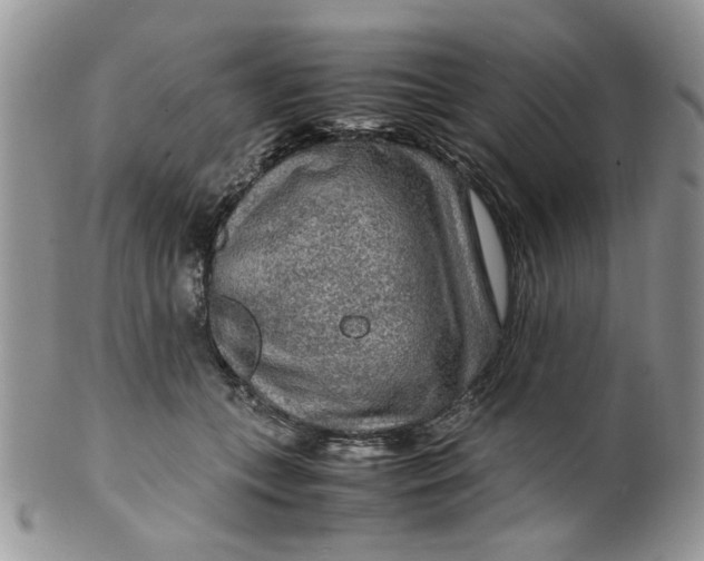 X0000099490559200806051101