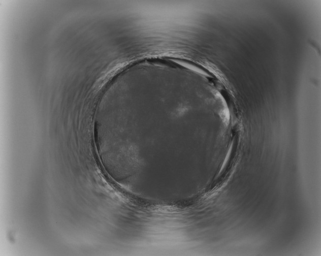 X0000099490577200806051101