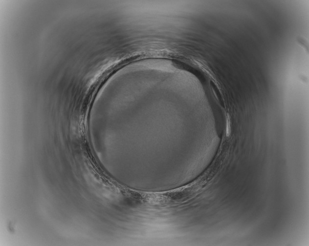 X0000099490579200806051101