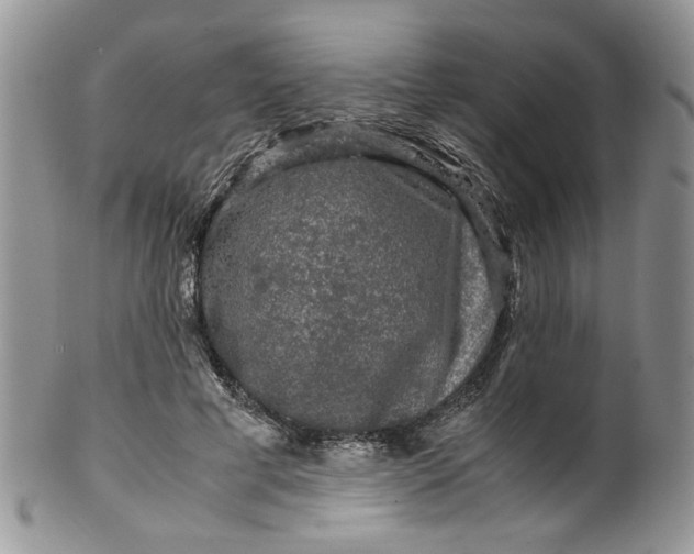 X0000099490593200806051100