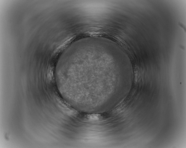 X0000099490618200806051100