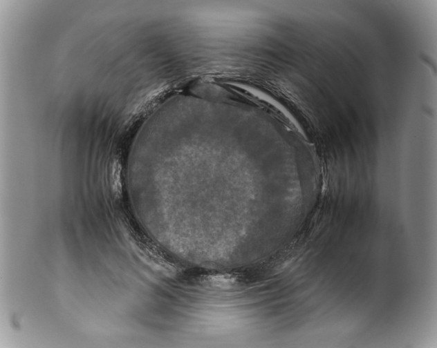 X0000099490692200806051059