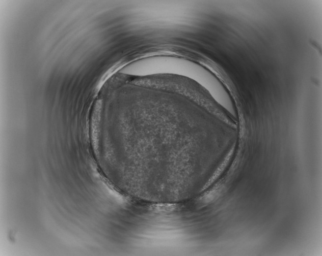 X0000099490858200806051057