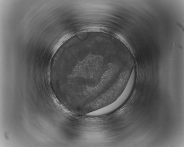 X0000099490994200806051054