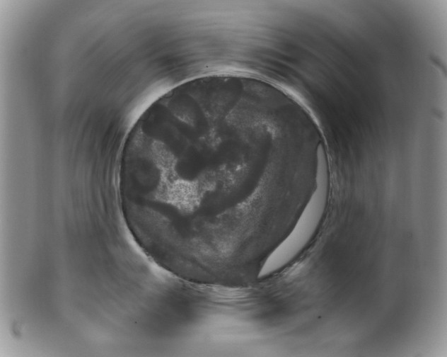 X0000099491007200806051054