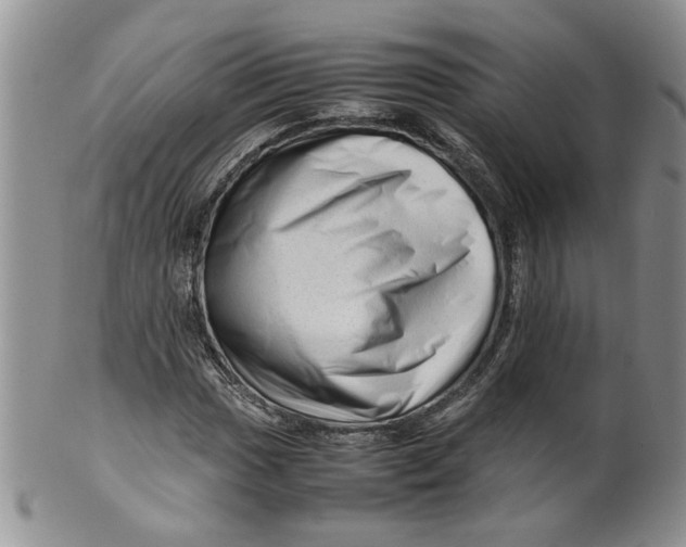 X0000099491017200806051054