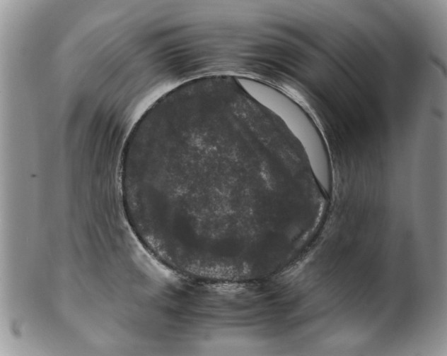 X0000099491141200806051053