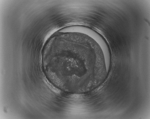 X0000099491179200806051052