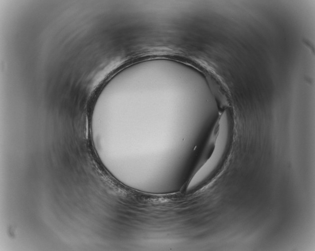 X0000099491317200806051049