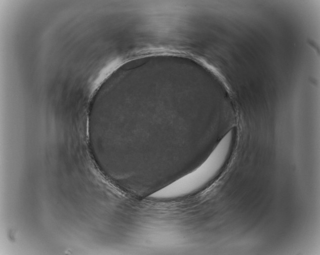 X0000099491365200806051049