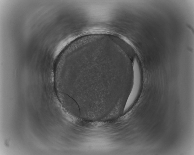 X0000099491461200806051047