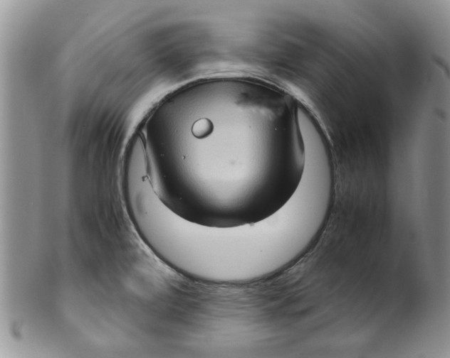 X0000099491472200806051047