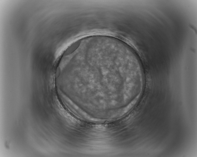 X0000099491504200806051046