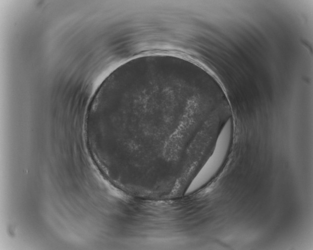 X0000099491533200806051047