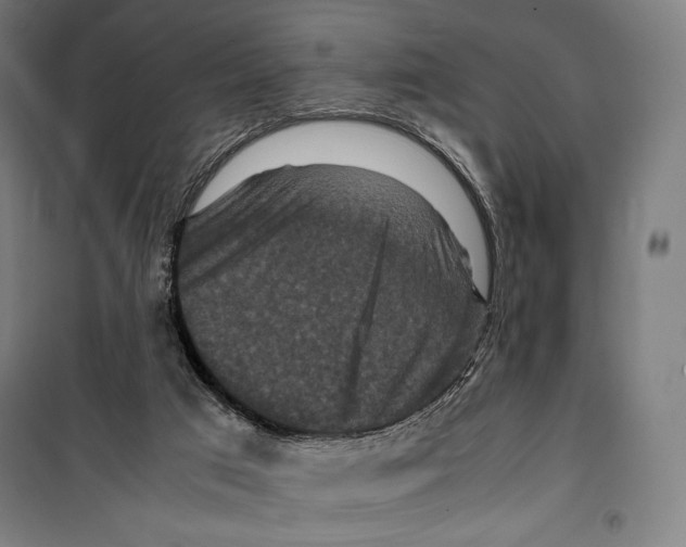 X0000099490017200806121403