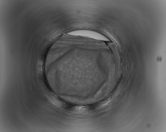 X0000099490117200806121401